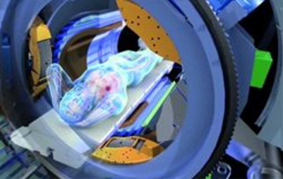 Korter en preciezer bestralen met nieuw MRI-bestralingsapparaat VUmc