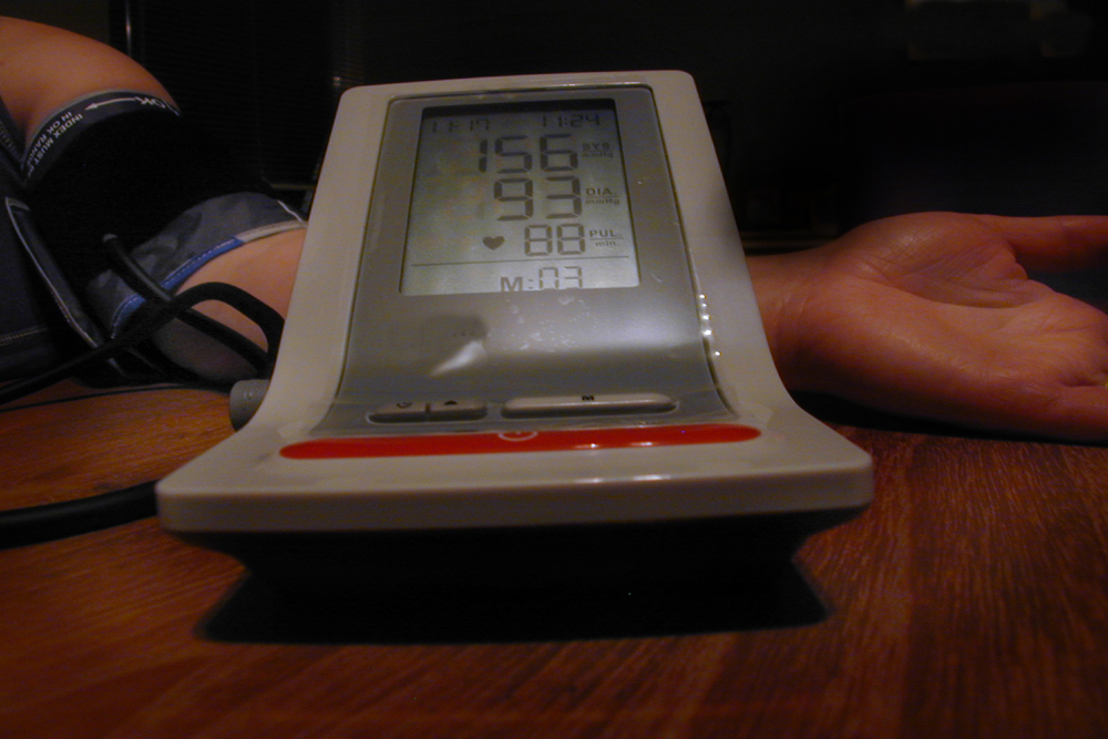 Foto van bloeddrukmeter en patiënt | Archief EHF