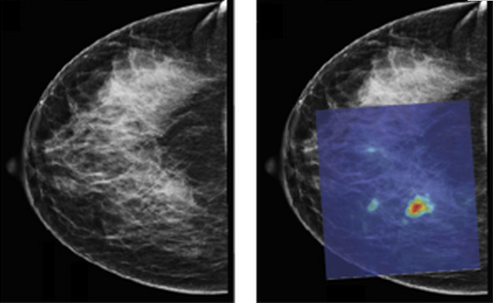 Foto van PAMmografie borstkanker | Universiteit Twente