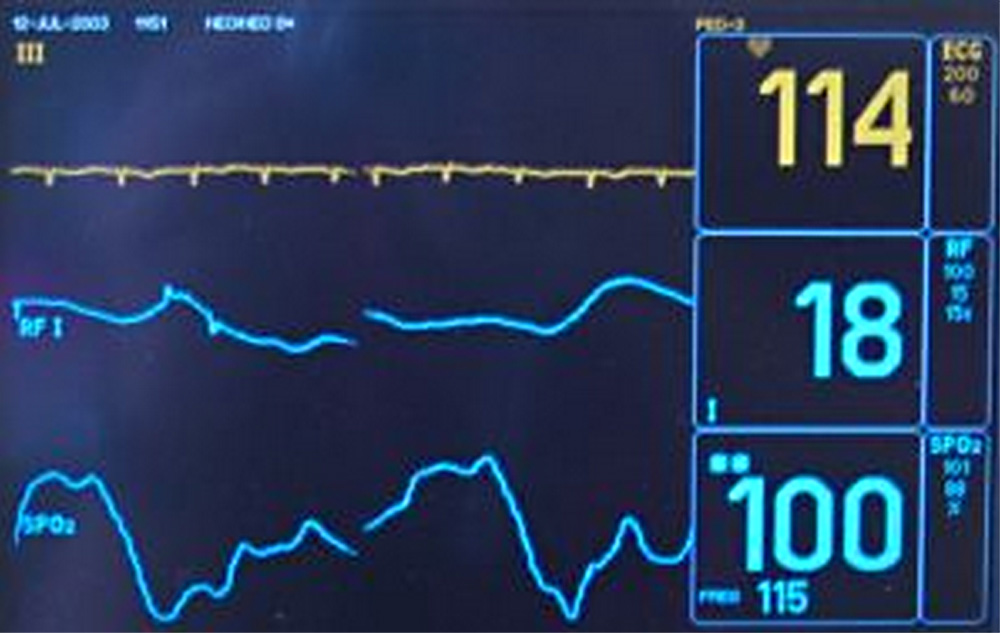 Fot ovan monitor met hartslag medisch | Stock.xchng
