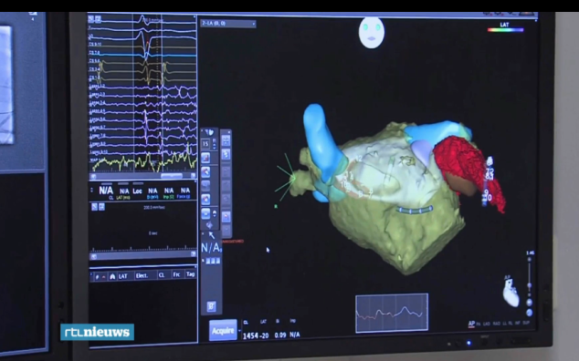 Maastricht UMC+ voert hartkatheterisatie uit met robot
