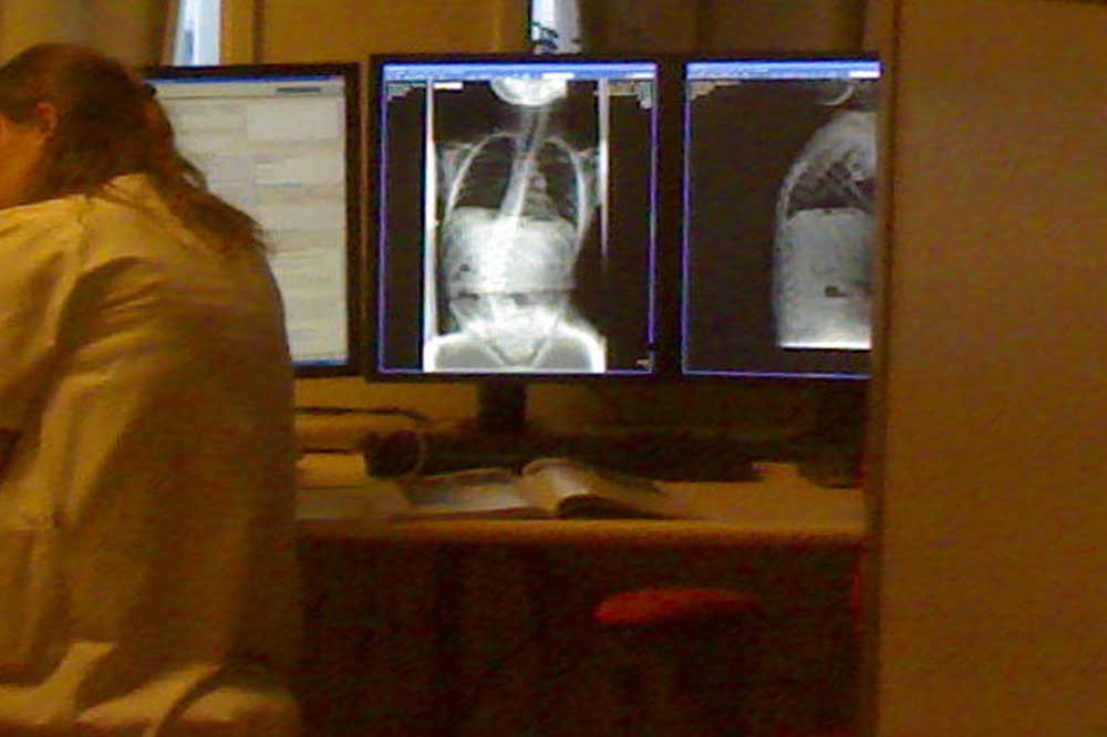 Foto van scan röntgen foto | Archief EHF