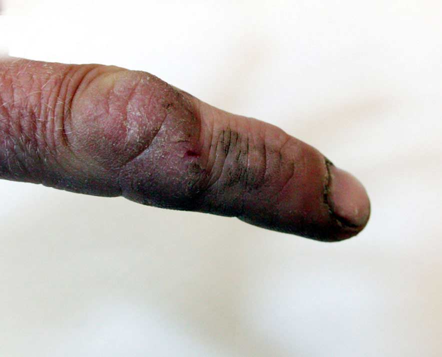 Kidnappers in Amstelveense ontvoeringszaak knipte vinger af van slachtoffer