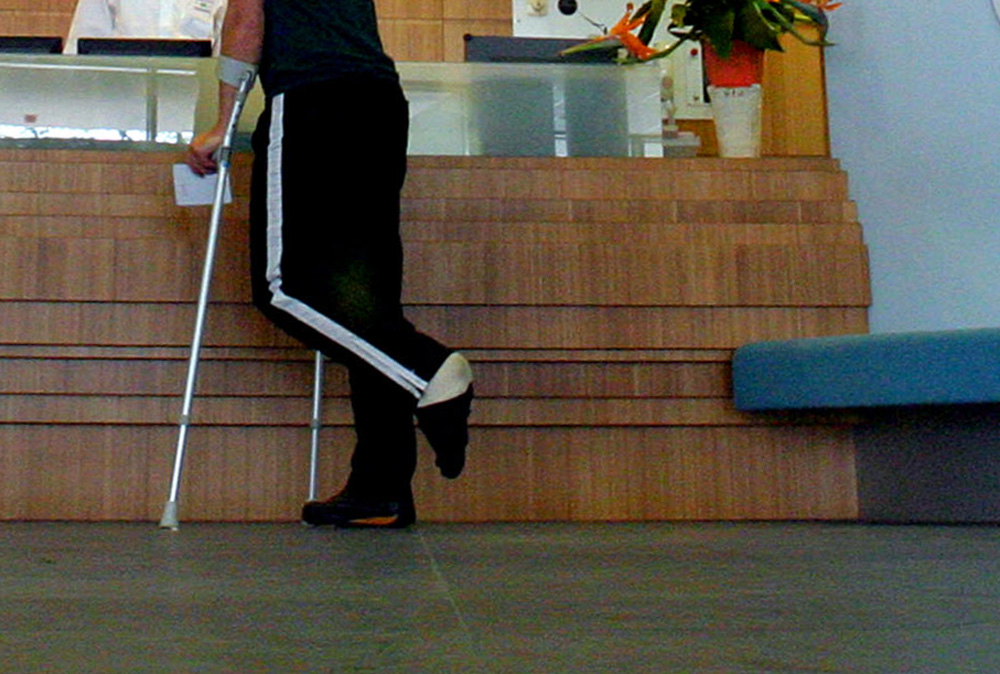 Foto van man met gebroken been in ziekenhuis | Archief EHF