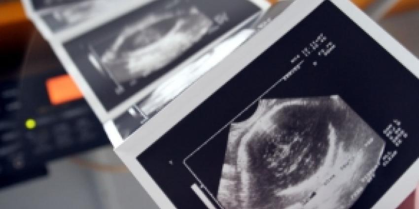 Gezondheidsraad adviseert aanbieden echo aan zwangere vrouwen al rond 13e week