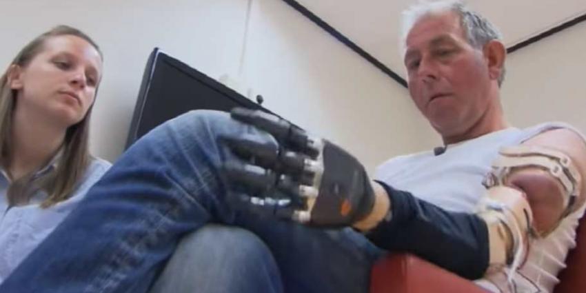 Radboudumc sluit eerste armklikprothese aan op zenuwen