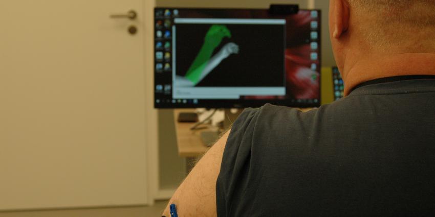 UMCG onderzoekt effect behandeling met virtual reality voor fantoompijn