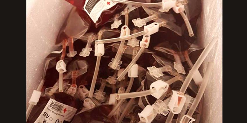 Alcohol in bloed of bloed in alcohol?