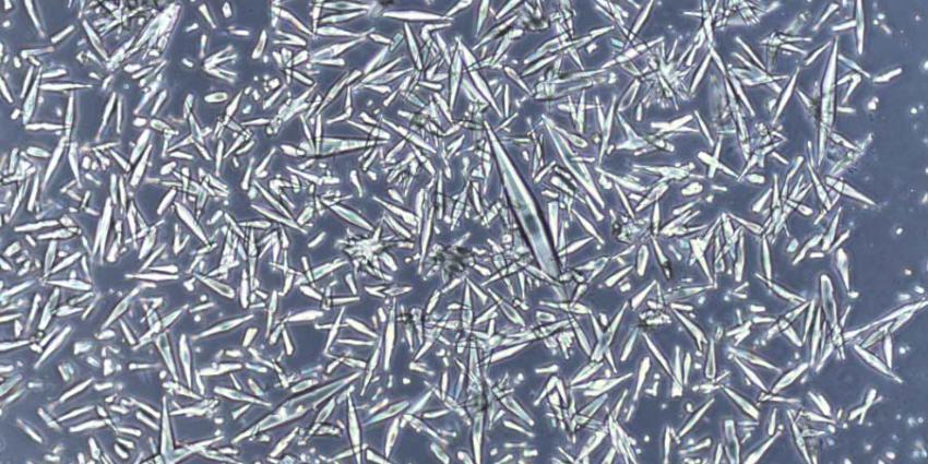 VIB Bioimaging Core_Amanda Concalves