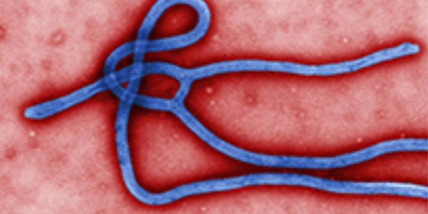 Eindhovenaar onderzocht in RadboudUMC op ebolavirus