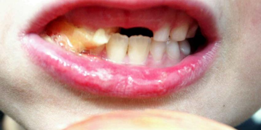 Te veel arsenicumgehalte in Nederlandse rijstproducten voor kinderen