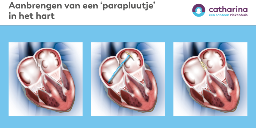 paraplu in hart