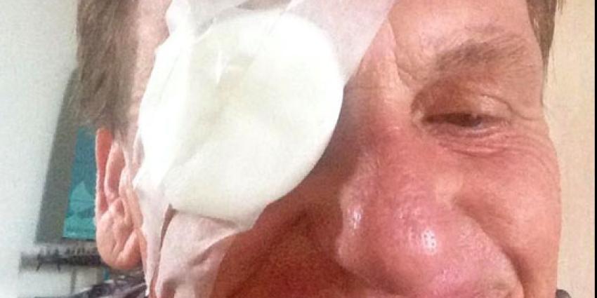 Henny Huisman ziekenhuis in door appel