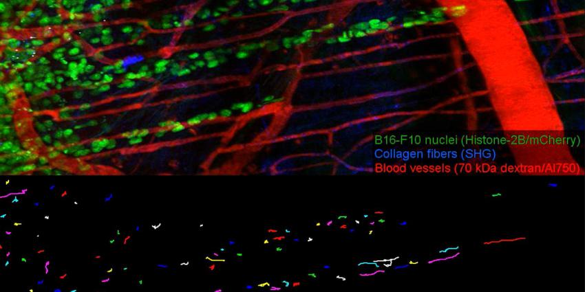 'Raar loopje' mogelijk de achilleshiel van kankercel