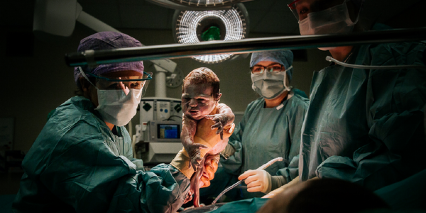 Ziekenhuis Amstelland geeft geboortefotograaf toegang tot operatiekamer 
