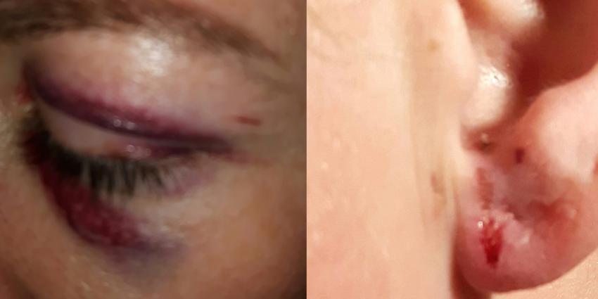 Mishandelde lesbische vrouwen voelen zich in de kou gezet door politie 