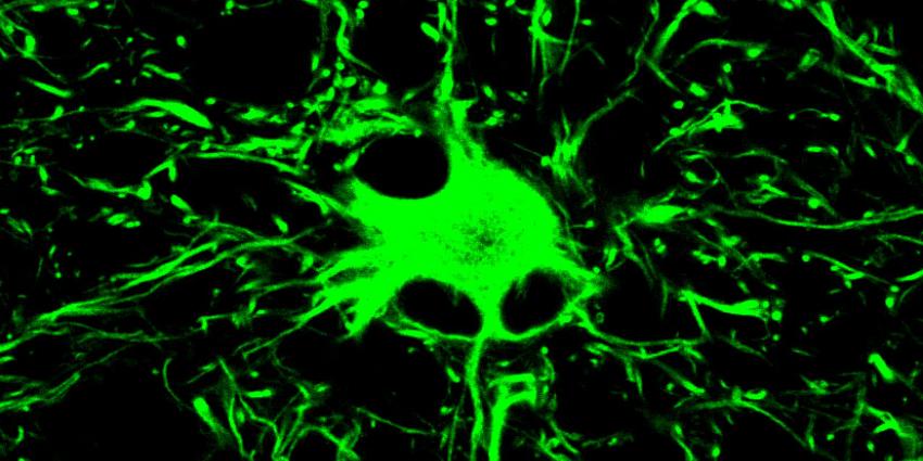 Onderzoeker ontmaskert dubbel spel van hersencellen in MS