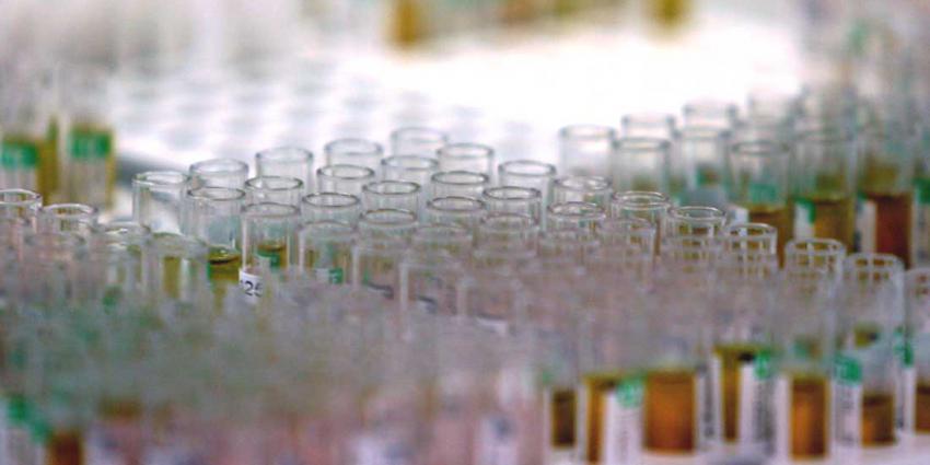Onderzoekers maken mini testnieren uit urinecellen