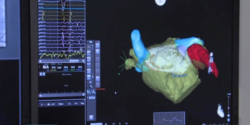 Maastricht UMC+ voert hartkatheterisatie uit met robot