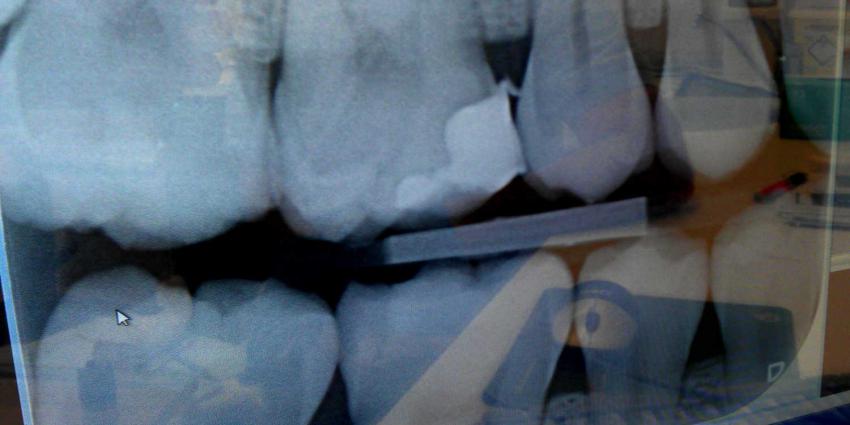 Tandartsen moeten regels röntgenfoto’s kinderen beter naleven