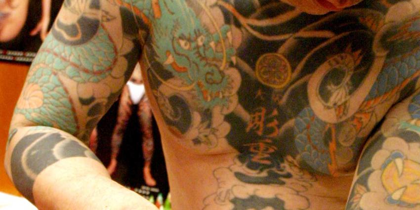 VUmc opent 'probleem-tattoo'-poli