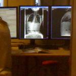 Foto van scan röntgen foto | Archief EHF