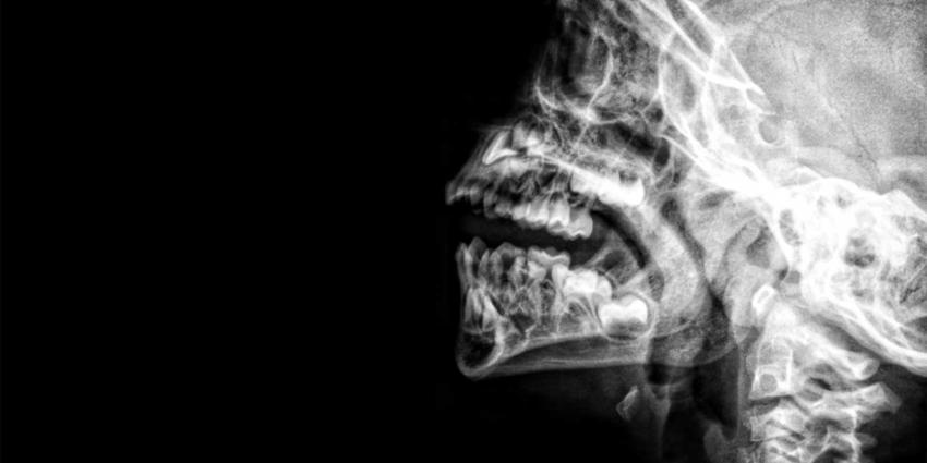rontgen-schedel-nek-gebit