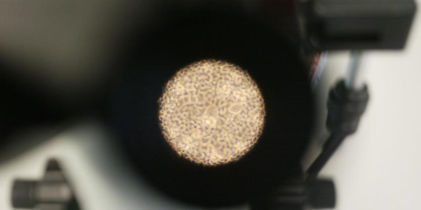 Rus injecteert zichzelf met 3,5 miljoen jaar oeroude bacterie