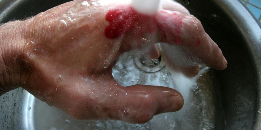 Grote vooruitgang in onderzoek naar genezing van brandwonden zonder littekens