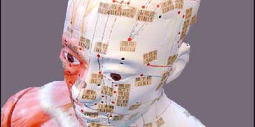  Ruim 1,1 miljoen euro subsidie voor LUMC -onderzoek beroertes