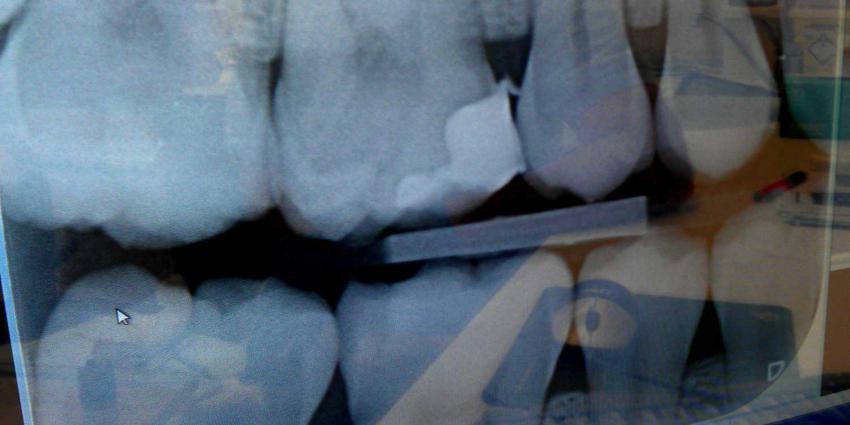 röntgenfoto-kiezen-gebit