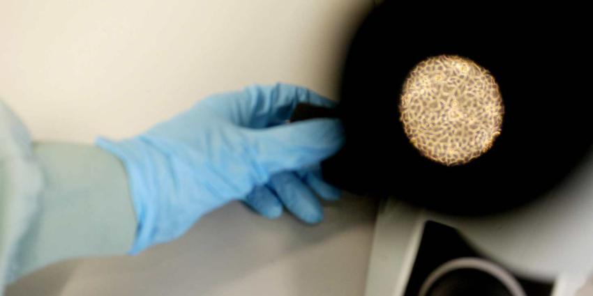 Dodelijke West Nijlvirus nu mogelijk ook in Duitsland aangetroffen