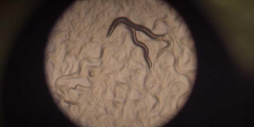 Laboratoriumwormen geven nieuw inzicht invloed dieet op veroudering