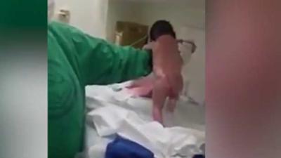 'Pasgeboren baby loopt rond'