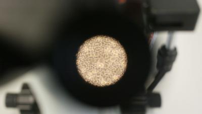 Rus injecteert zichzelf met 3,5 miljoen jaar oeroude bacterie