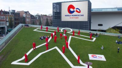 Per dag krijgen ruim 100 mensen een ernstige trombose