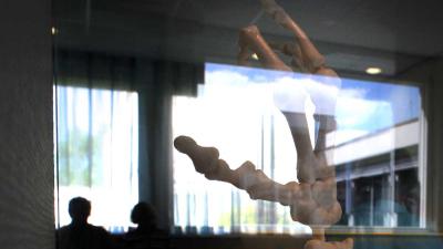 botjes-artrose-hand-ziekenh