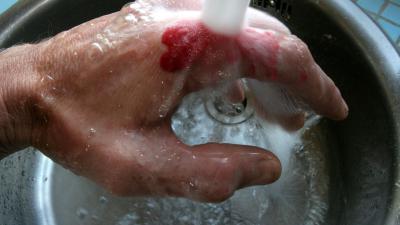 Grote vooruitgang in onderzoek naar genezing van brandwonden zonder littekens