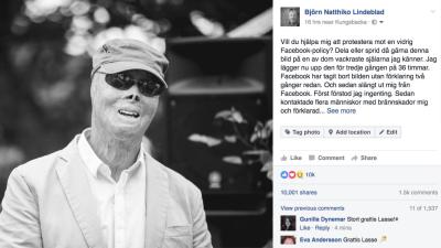 Facebook weer de fout in met brandwondenslachtoffer