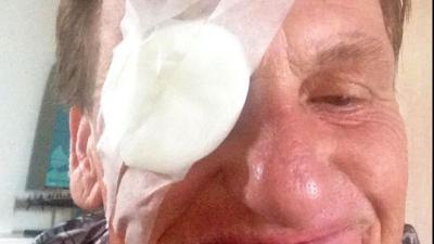 Henny Huisman ziekenhuis in door appel