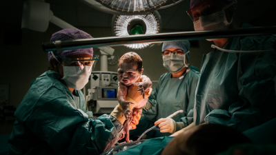 Ziekenhuis Amstelland geeft geboortefotograaf toegang tot operatiekamer 