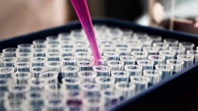 onderzoek-reageerbuisjes-laboratorium