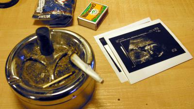 Vergoeding voor zwangere vrouwen die stoppen met roken