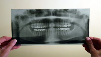 IGZ licht mondzorgsector door betreffende regels voor röntgenfoto’s