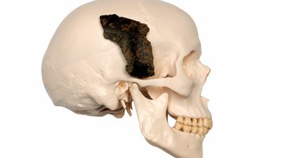 Foto van een voorbeeldschedel met het fragment | Futureland