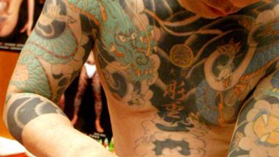 VUmc opent 'probleem-tattoo'-poli