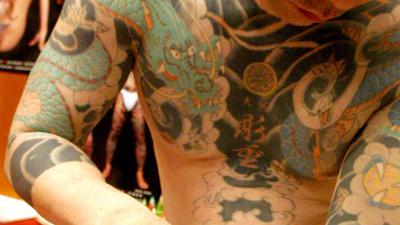 VUmc opent 'probleem-tattoo'-poli