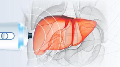 Maastricht UMC+ start polikliniek voor vetleverziekte