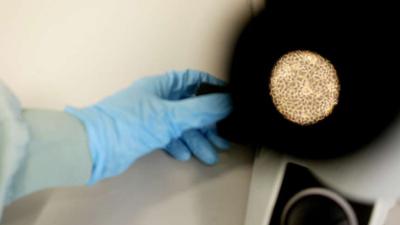 Apenpokkenvirus verspreidt zich snel in Europa