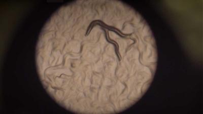 Laboratoriumwormen geven nieuw inzicht invloed dieet op veroudering